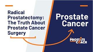Radical Prostatectomy for prostate cancer