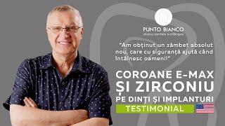 Coroane E-MAX și Zirconiu pe dinți și implanturi în Chișinău, Moldova | Testimonial