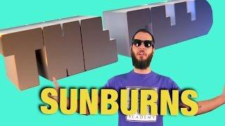 UMA: The Feed - How to Treat a Sunburn - Ultimate Medical Academy