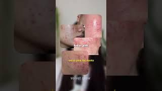  Stop Wasting Money! You’re Treating the Wrong Skin Issue