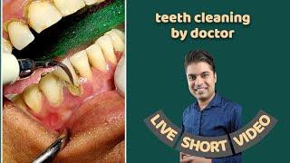 teeth cleaning by doctor । dentist preparing for teeth cleaning or removing tartar by machine