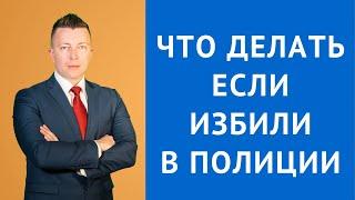 Что делать, если избили в полиции - Уголовный адвокат Москва