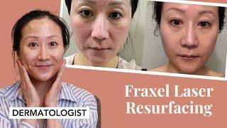 Dermatologist's experience with Dual Faxel Laser | Dr. Jenny Liu