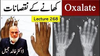 Oxalate, Worst dietary Plant Toxin  | Lecture 268