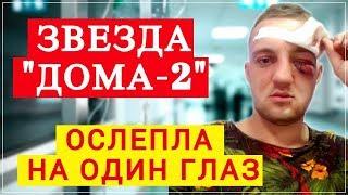 Участник "Дома-2" ослеп на один глаз | Новости Дом 2 | Top Show News