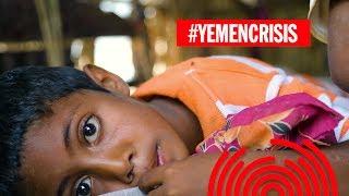 Six months since the Yemen Crisis - an update from Saleh Saeed