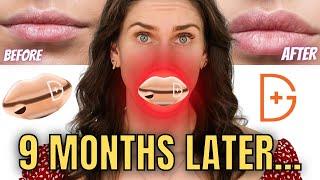 LED Plump Lips without Filler? Testing Dr. Dennis Gross LED Lip Spectralite Lipware PRO