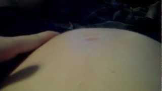 Crazy Fetal Movement 28 weeks