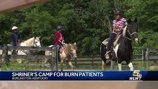 Cincinnati Shriners Hospital celebrates 30 years of special camp for burn patients