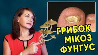 ГРИБОК / Мікоз / Фунгус / Dr. Ruslana Borysenko