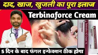 दाद, खाज, खुजली का पूरा इलाज - terbinafine cream / terbinafine hydrochloride cream / terbinafine