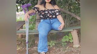 The beautiful woman has an amputated leg and life with one leg #amputada