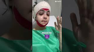 Minha CIRURGIA facial 