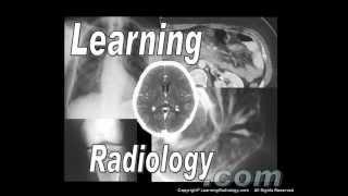 The Official LearningRadiology.com (TM) Channel