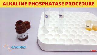 Alkaline Phosphatase Test | ALP Test