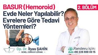 Basur (Hemoroid) için Evde Neler Yapılabilir? Basur (Hemoroid) Evrelerine Göre Tedavi Yöntemleri?