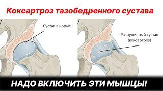 НАДО ВКЛЮЧИТЬ ЭТИ МЫШЦЫ! Коксартроз тазобедренного сустава