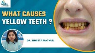 How to Whiten teeth? | How to Remove Brown Stained on Teeth | Daant Saaf Karne ka Tarika