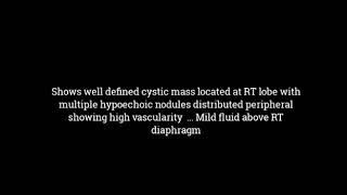 hepatocellular carcinoma ultrasound  Dr albashir osman Bahar