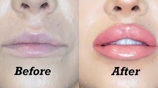 HOW TO GET BIGGER LIPS IN 5 MINUTES