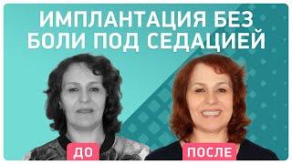 Полное восстановление зубов за пару дней  отзыв спустя 6 месяцев после имплантации