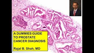 A Dummies Guide to Prostate Cancer Diagnosis