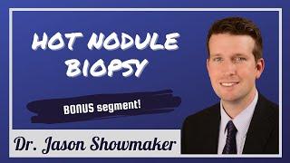 Thyroid biopsy of hot nodules: Dr. Jason Showmaker