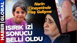 Narin Güran Cinayetinde Yeni Gelişme! Adli Tıp Raporu Ortaya Çıktı! Diş İzi Sonucu Belli Oldu