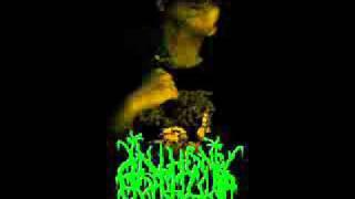 Anthony Portillo - The Bald Cadaver Cover (Cerebral Bore)