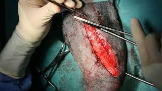 Femoral fracture plating in a dog