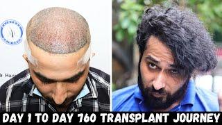20 month transplant result | Born Creator Clips