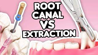 Root Canal vs. Tooth Extraction: What’s the Right Choice?