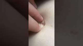 Ковыряние пупка. picking at the navel. Navel Pulse