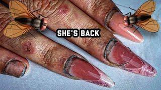 #HARDWORKER WOMAN GET’S HER RUINED NAILS TRANSFORMATION FROM #TOP #NAILTECH!