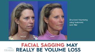 Why Facial Sagging May Really be Volume Loss