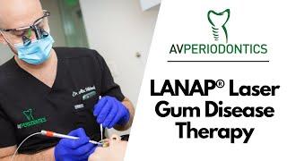 LANAP® Laser Gum Disease Therapy - Manhattan, NY - Dr. Alexander Volchonok