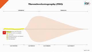 Thromboelastography (TEG) Explained