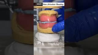Mounting of Wax Rims on Articulator | Rims Mounting Procedure #shorts #dentist #viral