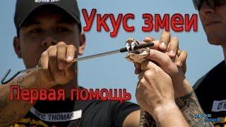 Укус змеи / SNAKE BITE