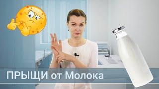 Прыщи от молока. Обзор косметолога