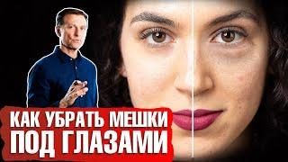 Мешки под глазами: как убрать? Какая причина отека под глазами? 