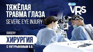 Тяжелая травма глаза. Хирургия c Унгурьяновым О. В. | Managing serious case of ocular trauma.