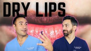 DRY, CHAPPED LIPS: DERMATOLOGY TIPS