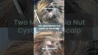 What do you think - macadamia nuts, right? ⁠⁠