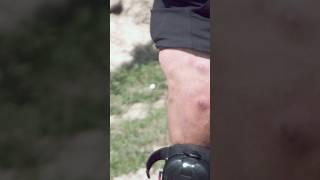 Shooting OFF a Chunk of Skin with a Less Lethal Rifle! (Ft. Kentucky Ballistics) #funny #memes