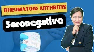 Understanding Seronegative Rheumatoid Arthritis: How It Mimics Other Arthritis Types