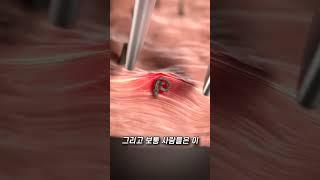 인그로운헤어 ㄷㄷ
