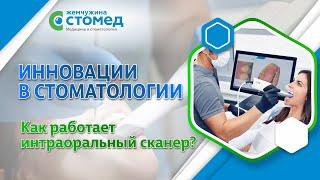 Инновации в стоматологии. Как работает интраоральный сканер?