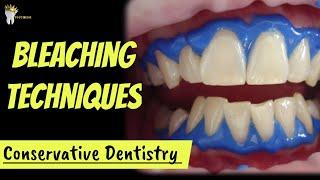 OPERATIVE DENTISTRY BLEACHING TECHNIQUES- IN OFFICE BLEACHING AND AT HOME BLEACHING