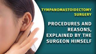 Tympanomastoidectomy Surgery at MRRM Hospital | Dr. Manish Arya | ENT Surgeon West Delhi